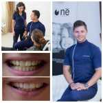 Dinti prea albi sau chipde papusa Barbie? Trendurile bombastice au fost date uitarii! papusa Barbie