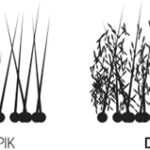 Toppik, solutia instanta impotriva calvitiei