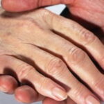 Cum se pot indeparta petele de varsta?